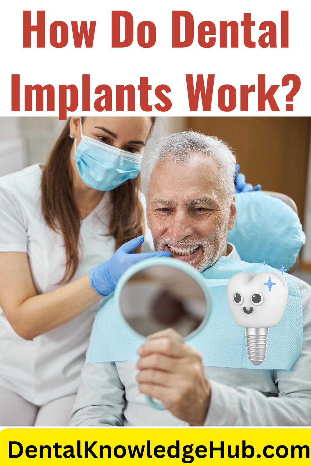 How Do Dental Implants Work - Dental Knowledge Hub