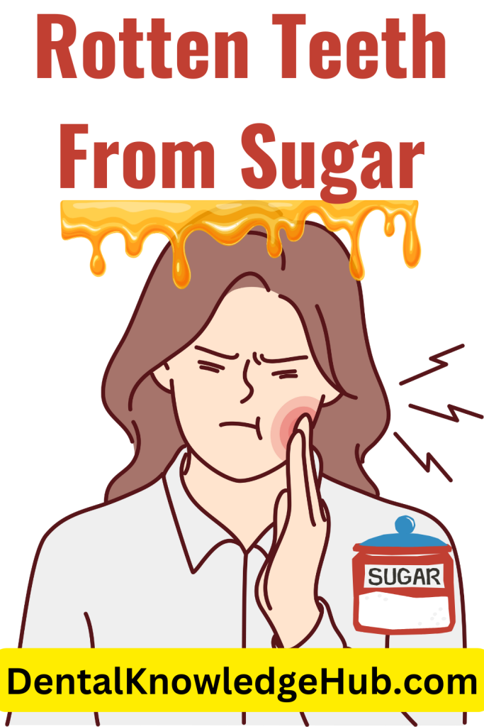 Rotten Teeth From Sugar - Dental Knowledge Hub