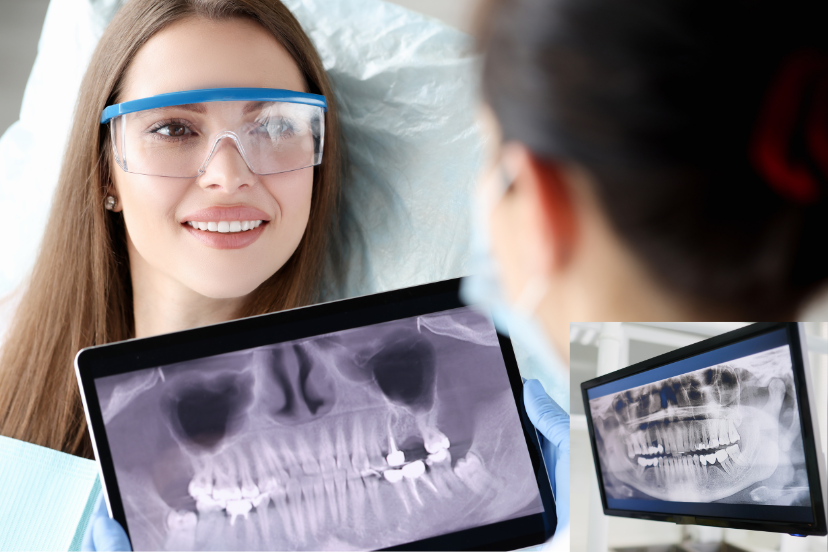 Can You See Tooth Decay On An X Ray - Dental Knowledge Hub