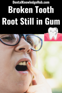Broken Tooth Root Still in Gum pin