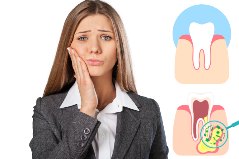 Gum Abscess Popped By Itself - Dental Knowledge Hub